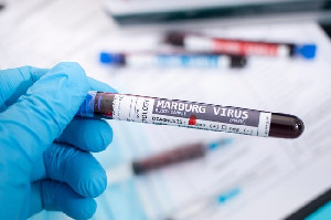 Masyarakat Diajak Mewaspadai Bahaya Virus Marburg
