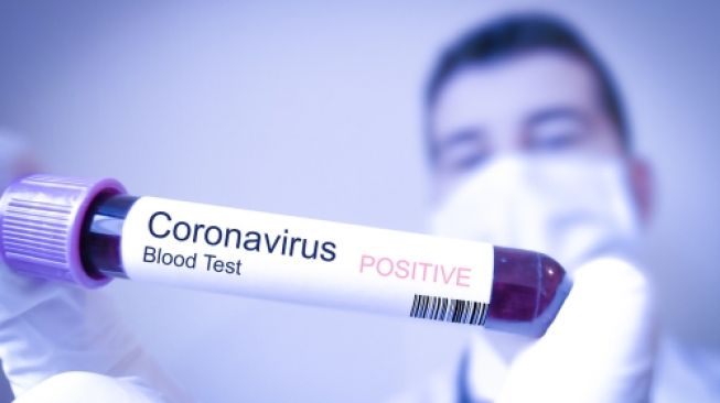 Dua Pertiga Penduduk Dunia Bisa Terjangkit Virus Corona