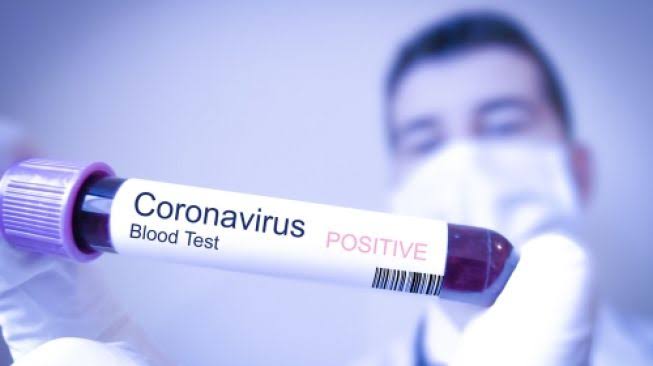 2 Orang Positif Terinfeksi, Kasus Virus Corona di Indonesia Menjadi 6 Orang