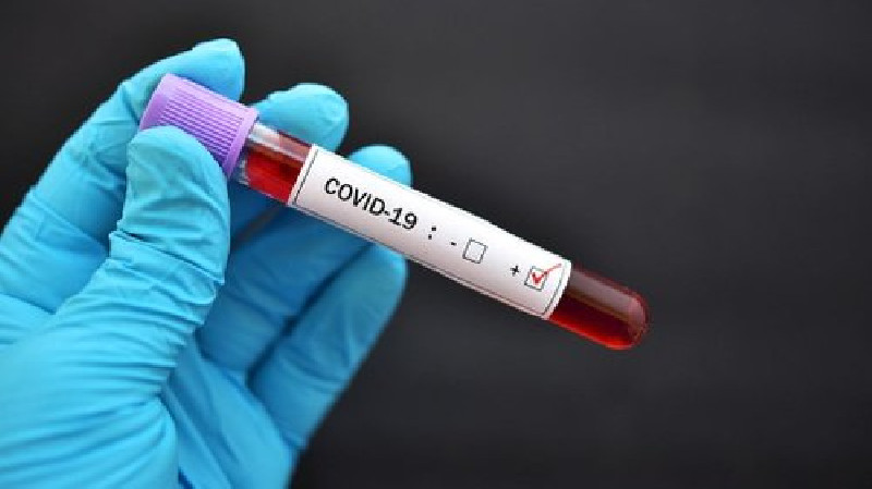 New York, California, Texas Tolak Rencana CDC Terkait Pengujian Covid-19