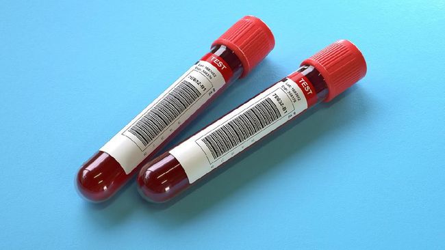 Penelitian di Inggris Temukan Hasil Tes Darah Pendeteksi 50 Kanker