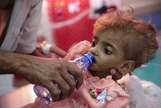 Tahun Ini, 400.000 Anak Balita Yaman Bisa Meninggal Kelaparan