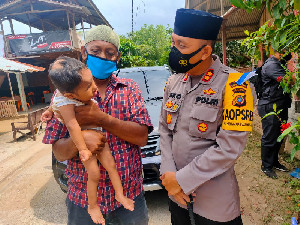 Kapolres Lhokseumawe Bantu Penderita Bibir Sumbing di Aceh Utara