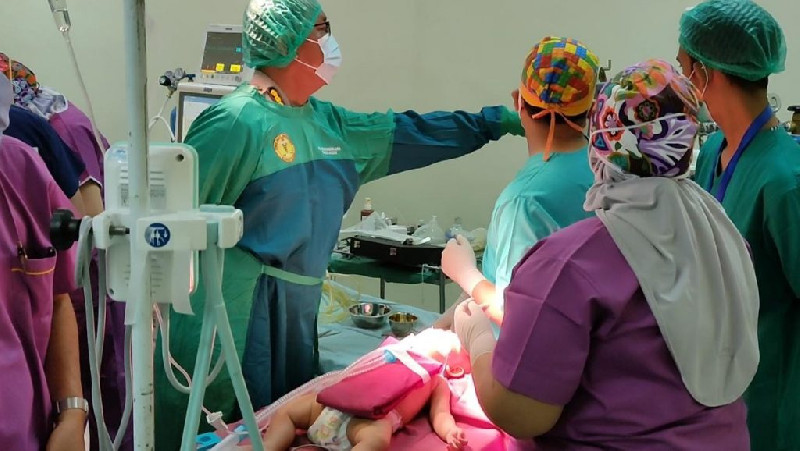 Polda Aceh Gelar Bakti Kesehatan Buka Operasi Bibir Sumbing Gratis