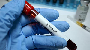 Kemenkes Sebut Penularan HIV-Sifilis 2023 Meningkat