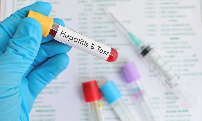 Peringati Hari Hepatitis Sedunia, Menkes Tekankan Pentingnya Deteksi Dini dan Pengobatan Terintegrasi