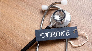 Remaja Putri Obesitas Berisiko Terkena Stroke di Usia 50 Tahun