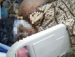 Tubuh Pelajar di Lhokseumawe Melepuh, Diduga Disiram Air Baterai oleh Ayah Tiri