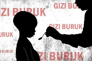 Stunting Aceh Turun Drastis, Tapi Masih 5 Besar Nasional!