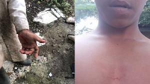 Kasus Penganiayaan Anak di Bawah Umur di Lamno, Pelaku Masih Berkeliaran
