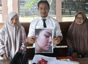 Polres Bireuen Dinilai Tidak Objektif Tangani Kasus Polisi Aniaya Adik Kandung
