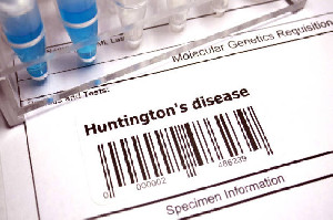 Terapi Gen Sekali Suntik Bisa Hambat Penyakit Huntington hingga 75%
