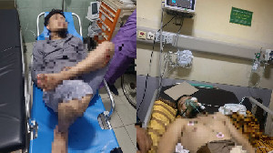 ASN Diskominsa Aceh Jadi Korban Jambret Brutal di Neusu Banda Aceh