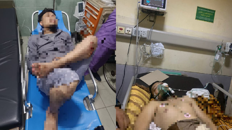 ASN Diskominsa Aceh Jadi Korban Jambret Brutal di Neusu Banda Aceh