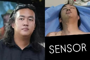 Kasus Air Keras Andrie: Pelaku Sudah Ada, Dalangnya Siapa?