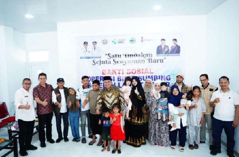 RSUD Datu Beru Gelar Operasi Bibir Sumbing dan Celah Langit Gratis