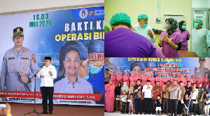 Bupati TRK Apresiasi Operasi Bibir Sumbing Gratis untuk Anak-anak di Nagan Raya