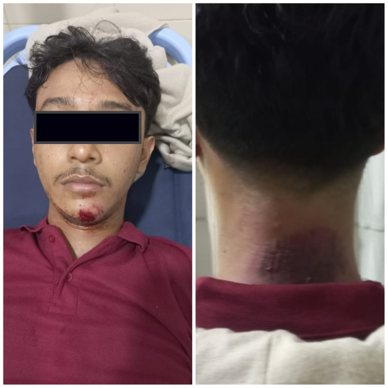 Mahasiswa FT USK Diserang OTK Bersenjata Celurit, Ketua BEM Ungkap Kronologi Mencekam di Kampus