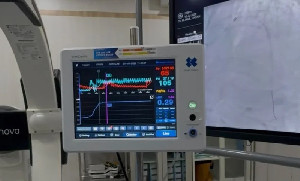 Pertama di Aceh, RSUD Meuraxa Perkuat Layanan Jantung dengan Vivo Cardio CPM