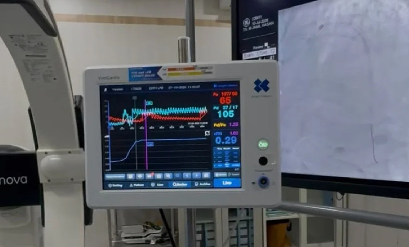 Pertama di Aceh, RSUD Meuraxa Perkuat Layanan Jantung dengan Vivo Cardio CPM