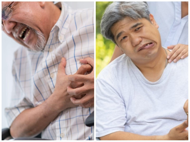 Terlihat Sehat, Kok Bisa Kena Stroke dan Penyakit Jantung?