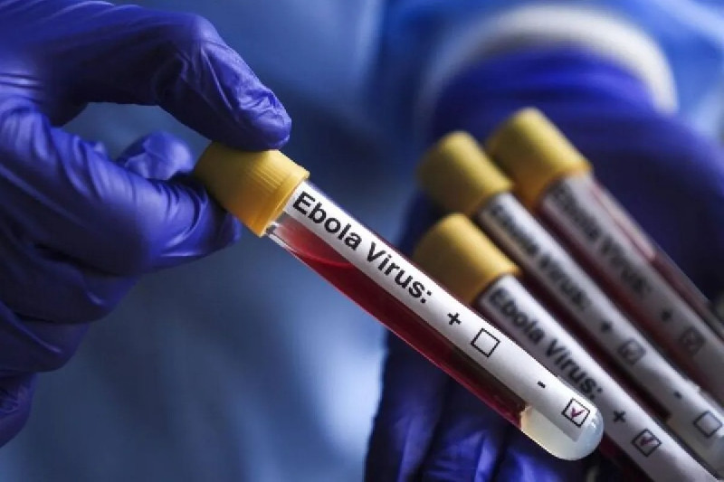 Ebola Muncul di Nigeria, Jalur Penularannya Masih Ditelusuri