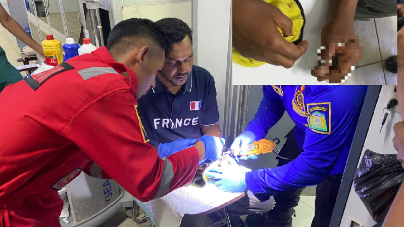 Menegangkan! Mata Kail Pancing Tersangkut di Jari Nelayan Aceh Besar