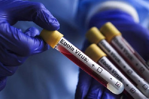 Ebola Muncul di Nigeria, Jalur Penularannya Masih Ditelusuri