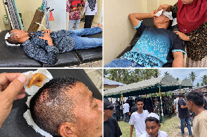 Maulid Nabi di Gampong Sagoe Pidie Berakhir Ricuh, Dua Warga Terluka
