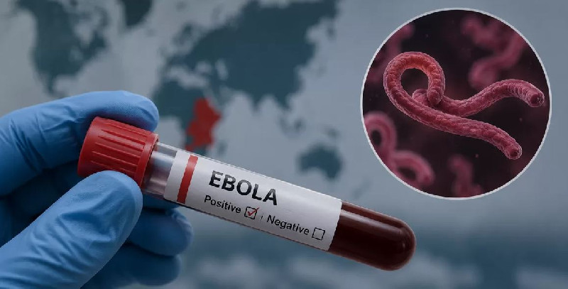 Kasus Ebola di Kenya Bertambah Jadi 8 Orang, 128 Masih Dikarantina